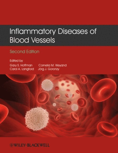 Jorg J. Goronzy, Carol A. Langford, Cornelia M. Weyand, Gary S. Hoffman - Inflammatory Diseases of Blood Vessels, E-bok