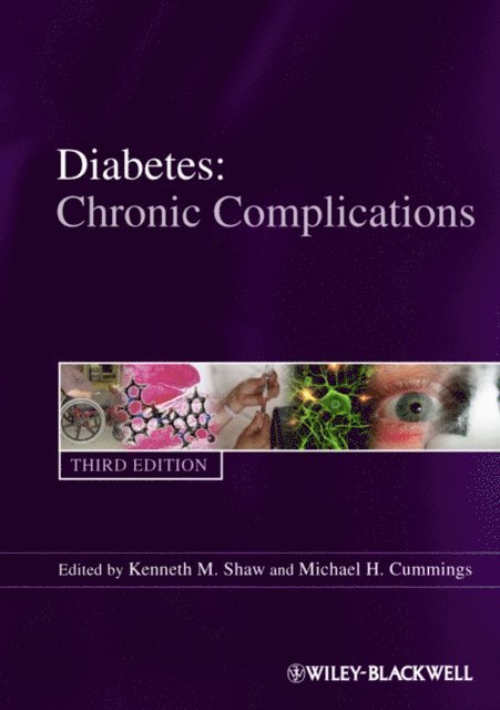 Michael H. Cummings, Kenneth M. Shaw - Diabetes, E-bok