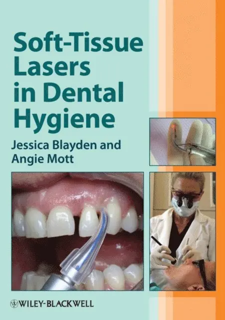 Angie Mott, Jessica Blayden - Soft-Tissue Lasers in Dental Hygiene, E-bok. Tillgänglighet: Lägg i varukorg