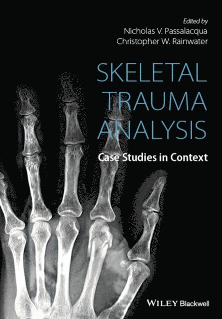 Christopher W. Rainwater, Nicholas V. Passalacqua - Skeletal Trauma Analysis, E-bok