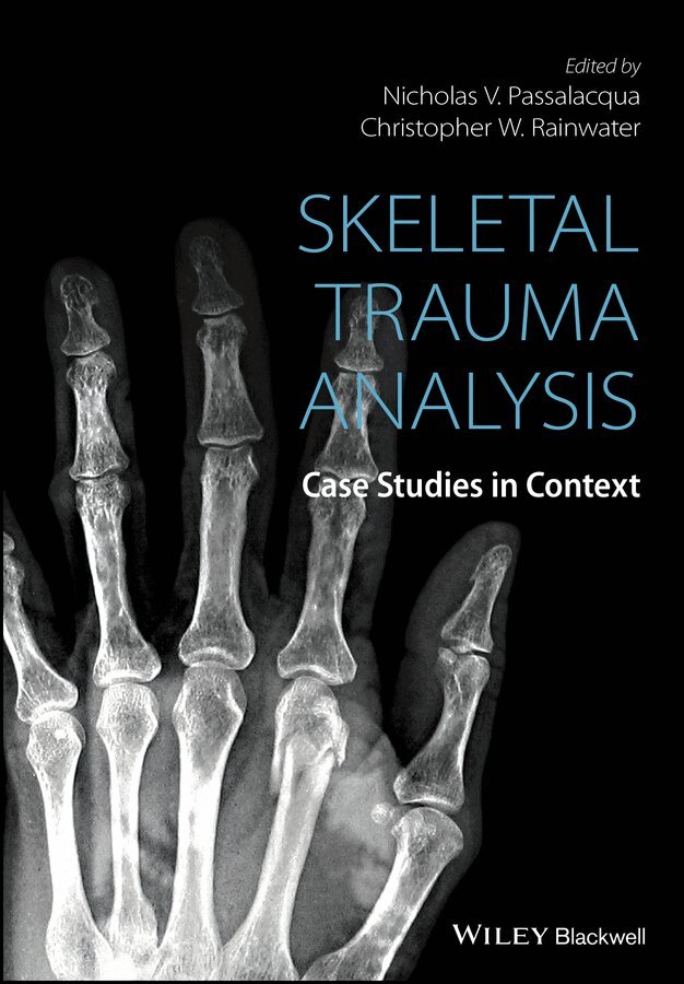 Nicholas V. Passalacqua, Christopher W. Rainwater - Skeletal Trauma Analysis – Case Studies in Context. Tillgänglighet: Tillfälligt slut