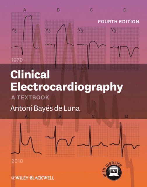 Antoni Bay s de Luna - Clinical Electrocardiography, E-bok