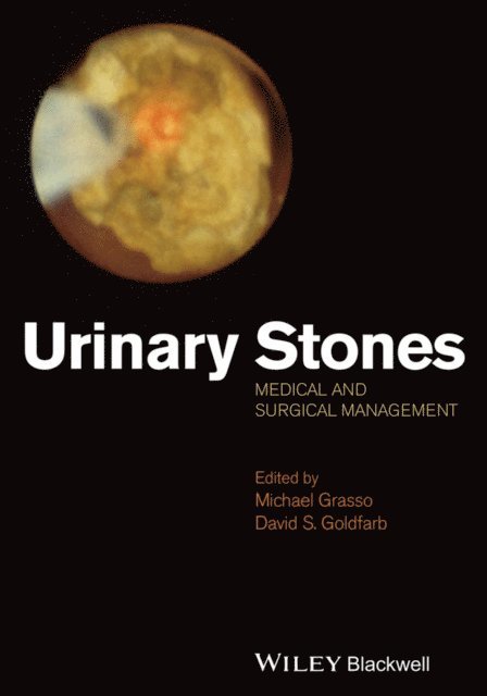 David Goldfarb, Michael Grasso - Urinary Stones, E-bok