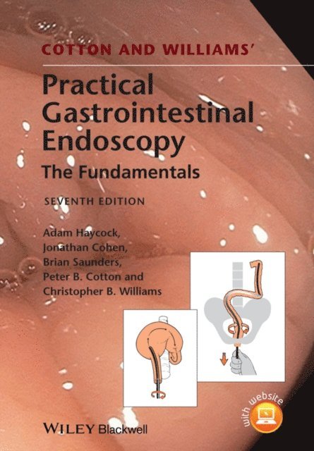Christopher B. Williams, Peter B. Cotton, Brian P. Saunders, Jonathan Cohen, Adam Haycock - Cotton and Williams' Practical Gastrointestinal Endoscopy, E-bok