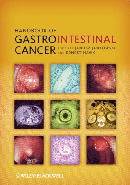 Ernest Hawk, Janusz A. Z. Jankowski - Handbook of Gastrointestinal Cancer, E-bok
