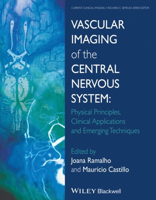 Mauricio Castillo, Joana Ramalho - Vascular Imaging of the Central Nervous System, E-bok