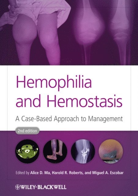 Miguel A. Escobar, Harold R. Roberts, Alice D. Ma - Hemophilia and Hemostasis, E-bok. Tillgänglighet: Lägg i varukorg