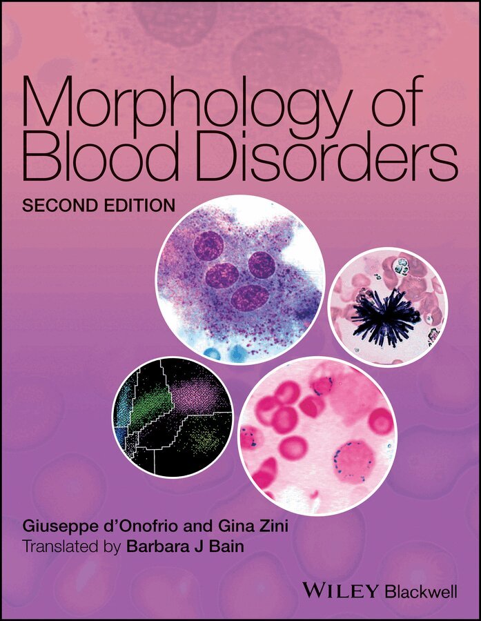 Giuseppe d'Onofrio, Gina Zini - Morphology of Blood Disorders 2e. Tillgänglighet: Tillfälligt slut