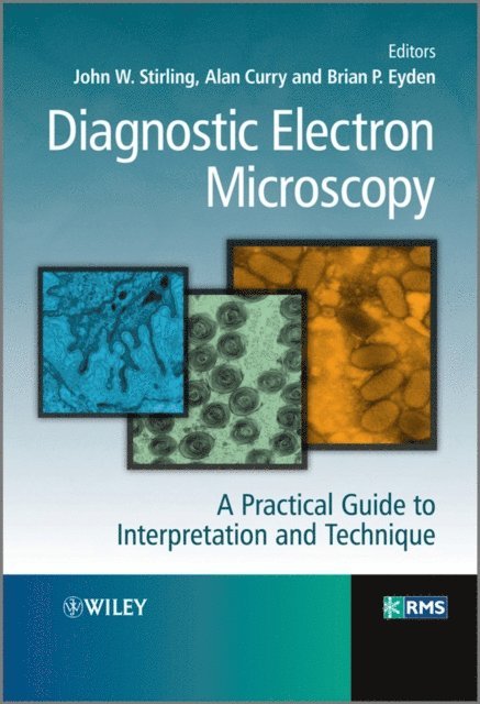 Brian Eyden, Alan Curry, John Stirling - Diagnostic Electron Microscopy, E-bok