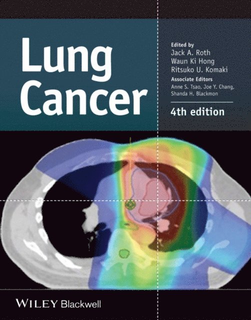 Ritsuko U. Komaki, Waun Ki Hong, Jack A. Roth - Lung Cancer, E-bok