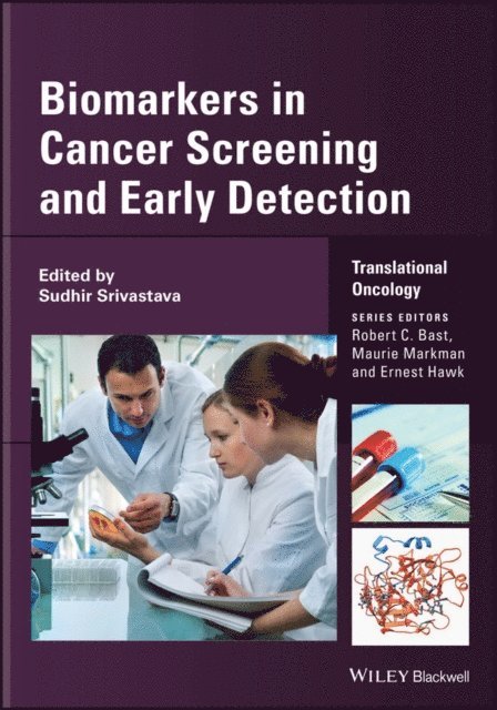 Sudhir Srivastava - Biomarkers in Cancer Screening and Early Detection, E-bok