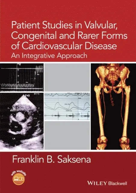Franklin B. Saksena - Patient Studies in Valvular, Congenital, and Rarer Forms of Cardiovascular Disease, E-bok. Tillgänglighet: Lägg i varukorg