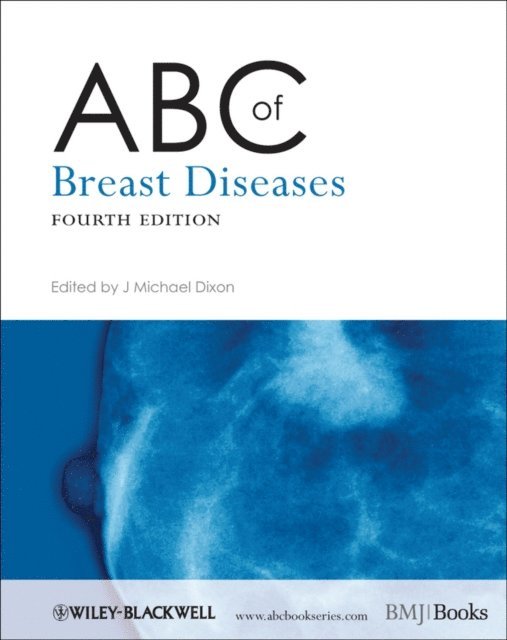 J. Michael Dixon - ABC of Breast Diseases, E-bok