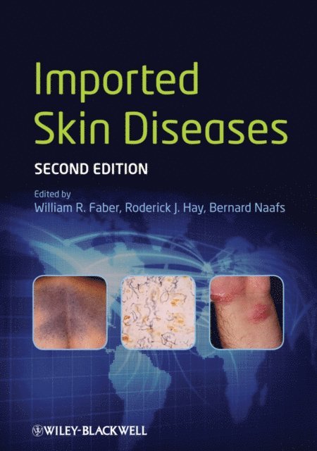 Bernard Naafs, Roderick J. Hay, William R. Faber - Imported Skin Diseases, E-bok