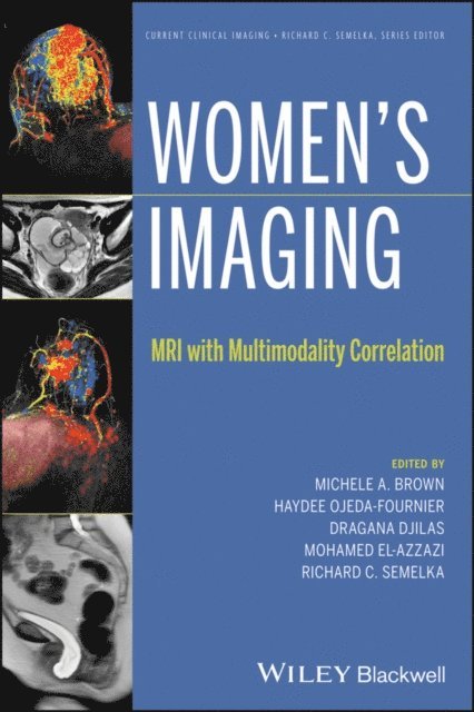 Richard C. Semelka, Mohamed El-Azzazi, Dragana Djilas, Haydee Ojeda-Fournier, Michele A. Brown - Women's Imaging, E-bok