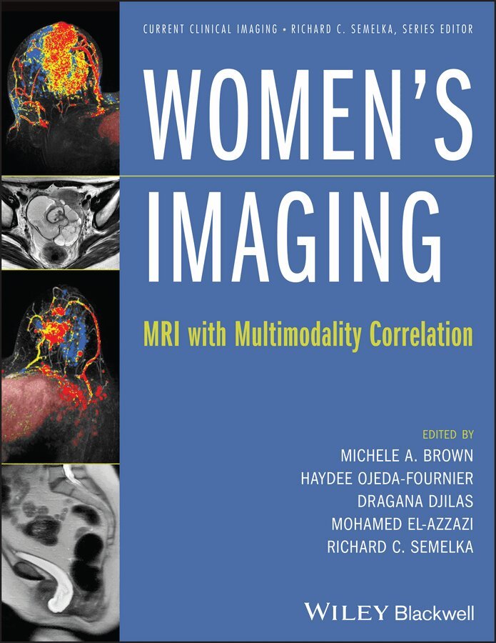 MA Brown - Women′s Imaging – MRI with Multimodality Correlation. Tillgänglighet: Tillfälligt slut