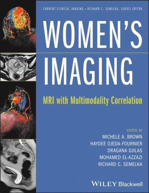 Richard C. Semelka, Mohamed El-Azzazi, Dragana Djilas, Haydee Ojeda-Fournier, Michele A. Brown - Women's Imaging, E-bok