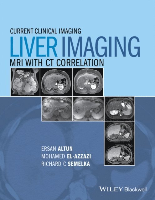 Richard C. Semelka, Mohamed El-Azzazi, Ersan Altun - Liver Imaging, E-bok