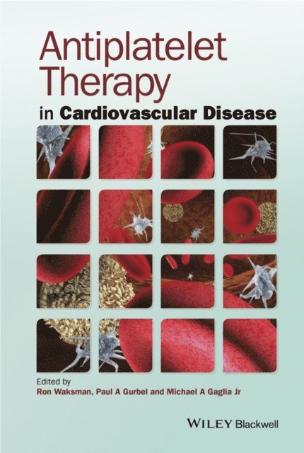 Jr. Michael A. Gaglia, Paul A. Gurbel, Ron Waksman - Antiplatelet Therapy in Cardiovascular Disease, E-bok