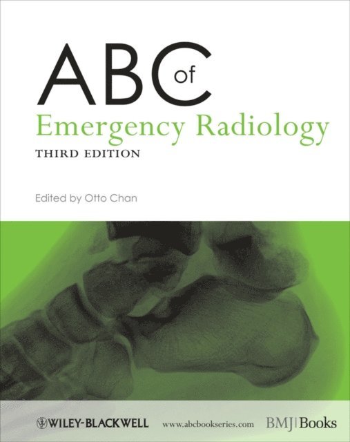 Otto Chan - ABC of Emergency Radiology, E-bok