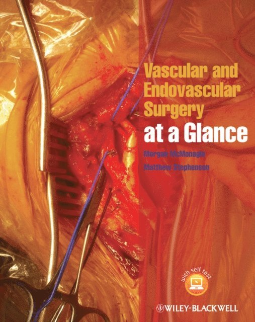 Matthew Stephenson, Morgan McMonagle - Vascular and Endovascular Surgery at a Glance, E-bok