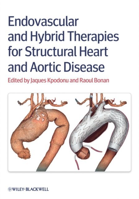 Raoul Bonan, Jacques Kpodonu - Endovascular and Hybrid Therapies for Structural Heart and Aortic Disease, E-bok