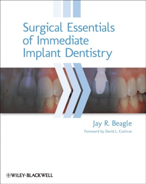 Jay R. Beagle - Surgical Essentials of Immediate Implant Dentistry, E-bok. Tillgänglighet: Lägg i varukorg