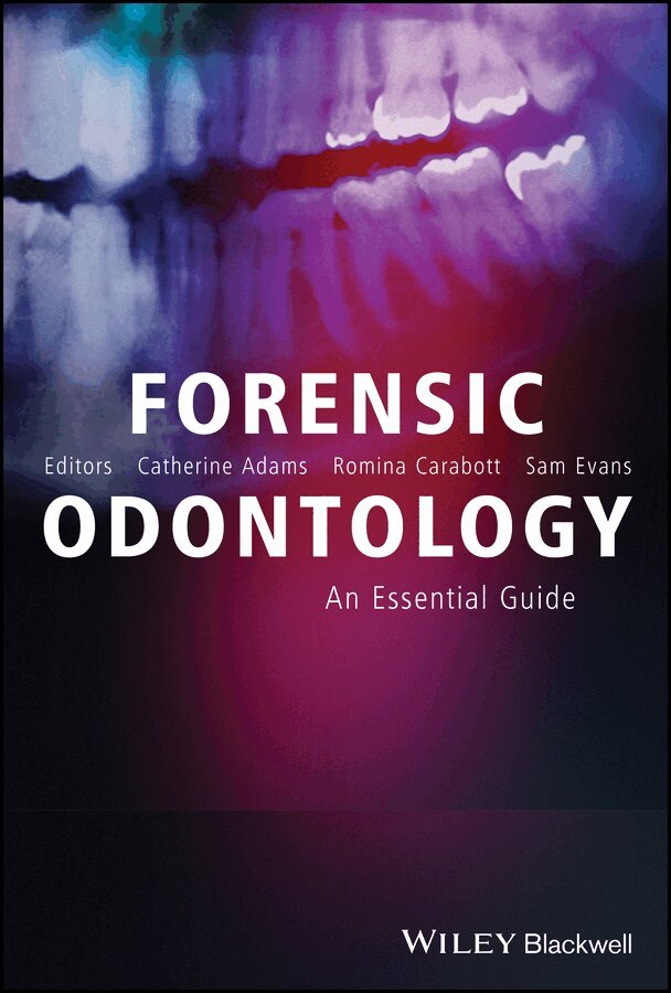 Catherine Adams, Romina Carabott, Sam Evans - Forensic Odontology – An Essential Guide. Tillgänglighet: Tillfälligt slut