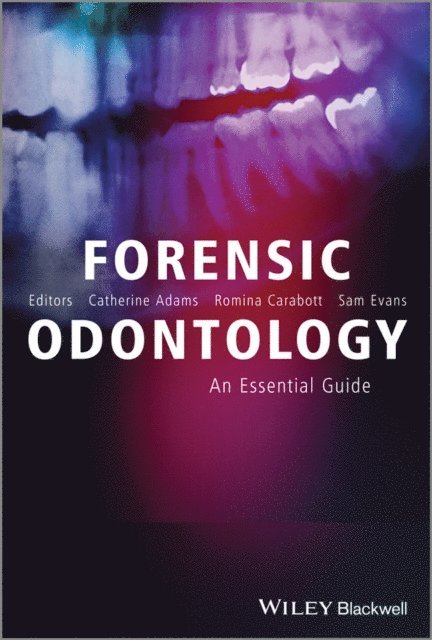 Sam Evans, Romina Carabott, Catherine Adams - Forensic Odontology, E-bok
