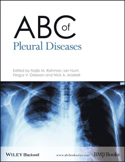 Nick A. Maskell, Fergus V. Gleeson, Ian Hunt, Najib M. Rahman - ABC of Pleural Diseases, E-bok