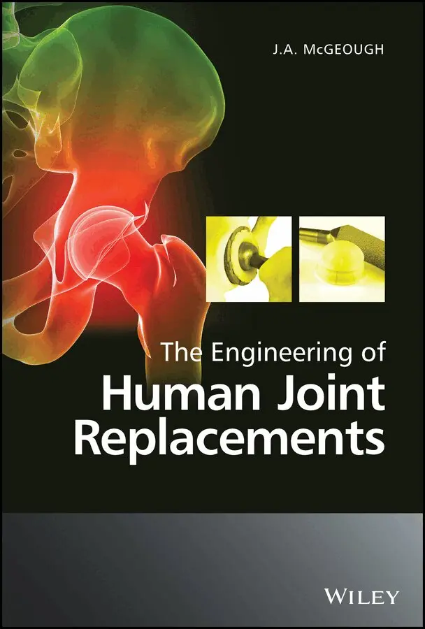 JA McGeough - Engineering of Human Joint Replacements. Tillgänglighet: Tillfälligt slut