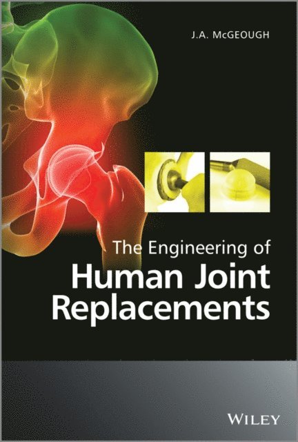 J. A. McGeough - Engineering of Human Joint Replacements, E-bok