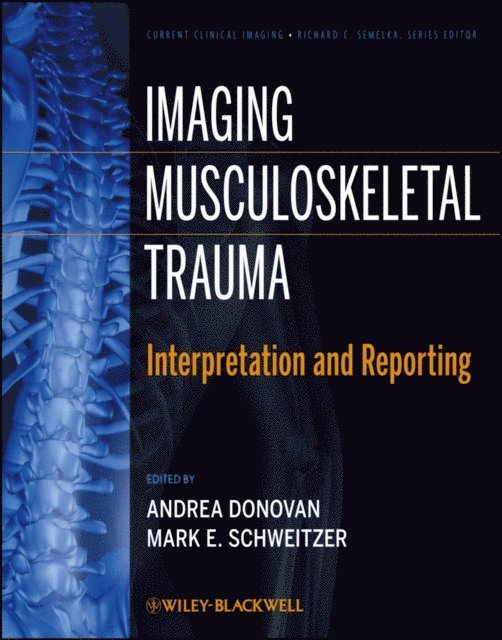 Mark E. Schweitzer, Andrea Donovan - Imaging Musculoskeletal Trauma, E-bok