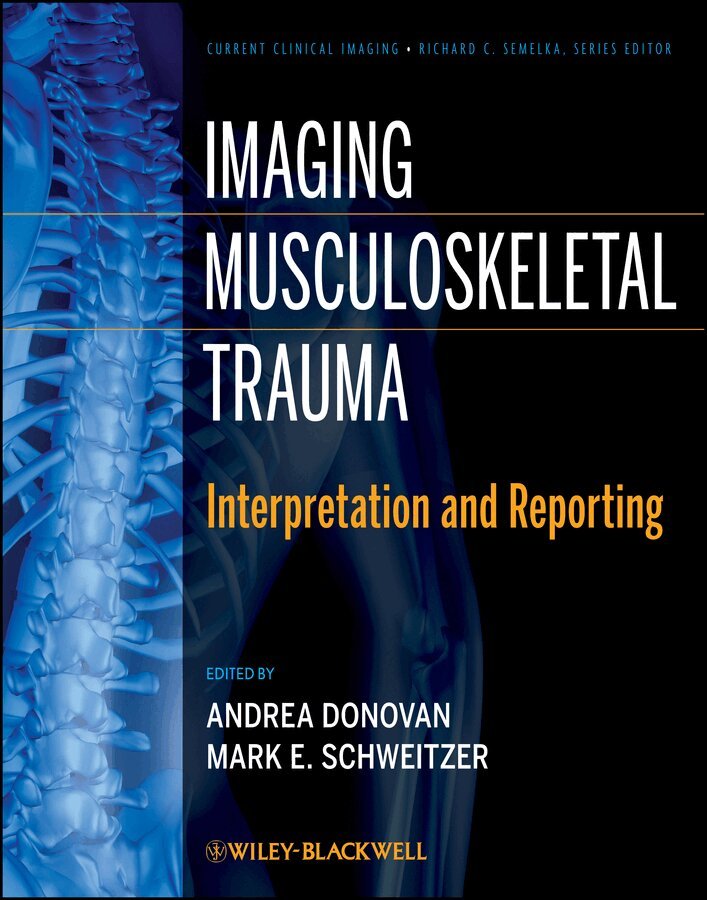 Andrea Donovan, Mark E. Schweitzer - Imaging Musculoskeletal Trauma – Interpretation and Reporting. Tillgänglighet: Tillfälligt slut