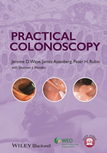 Peter H. Rubin, James Aisenberg, Jerome D. Waye - Practical Colonoscopy, E-bok