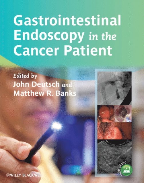 Matthew R. Banks, John C. Deutsch - Gastrointestinal Endoscopy in the Cancer Patient, E-bok. Tillgänglighet: Lägg i varukorg
