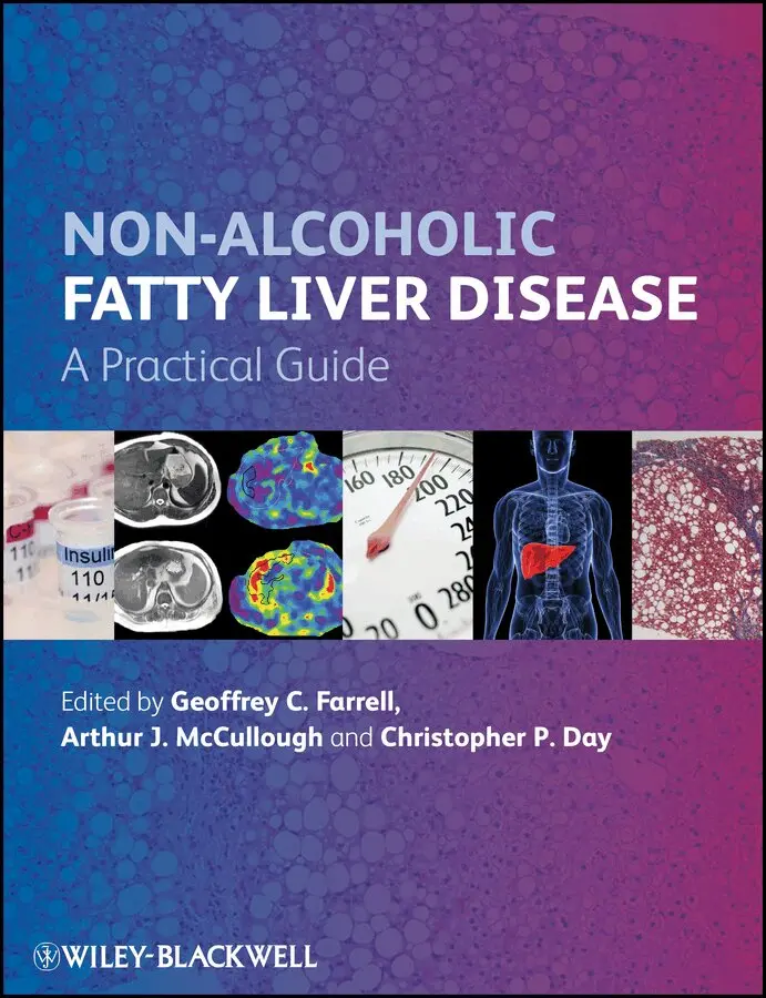 G Farrell - Non–Alcoholic Fatty Liver Disease – A Practical Guide. Tillgänglighet: Tillfälligt slut