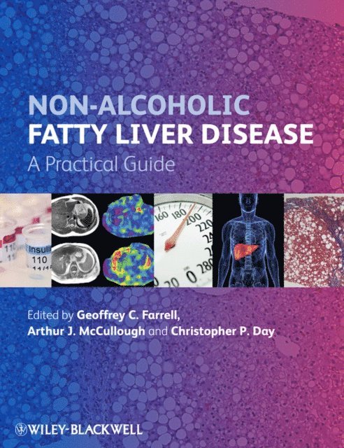 Christopher P. Day, Arthur J. McCullough, Geoffrey C. Farrell - Non-Alcoholic Fatty Liver Disease, E-bok