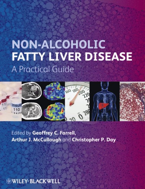 Christopher P. Day, Arthur J. McCullough, Geoffrey C. Farrell - Non-Alcoholic Fatty Liver Disease, E-bok