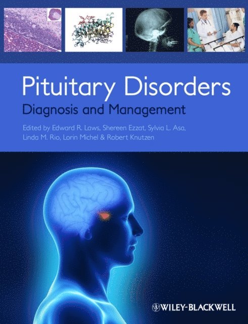 Robert Knutzen, Lorin Michel, Linda M. Rio, Sylvia L. Asa, Shereen Ezzat, Edward R. Laws - Pituitary Disorders, E-bok