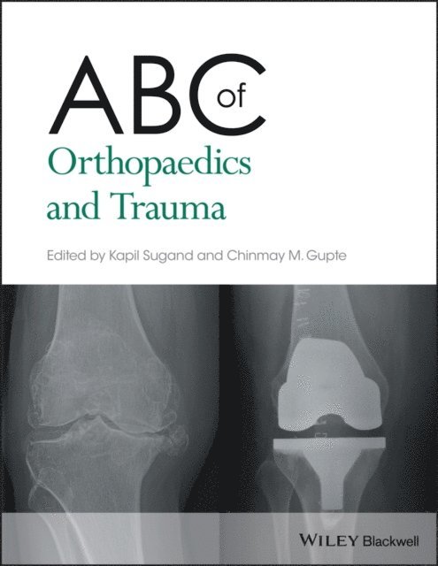Chinmay M. Gupte, Kapil Sugand - ABC of Orthopaedics and Trauma, E-bok