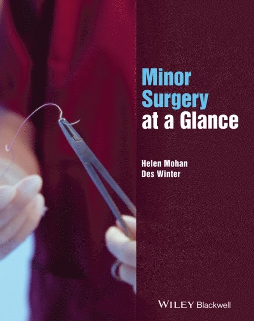 Desmond C. Winter, Helen Mohan - Minor Surgery at a Glance, E-bok