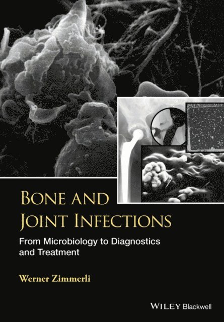 W. Zimmerli - Bone and Joint Infections, E-bok