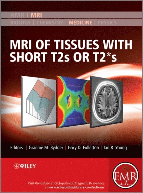 Ian R. Young, Gary D. Fullerton, Graeme M. Bydder - MRI of Tissues with Short T2s or T2*s, E-bok