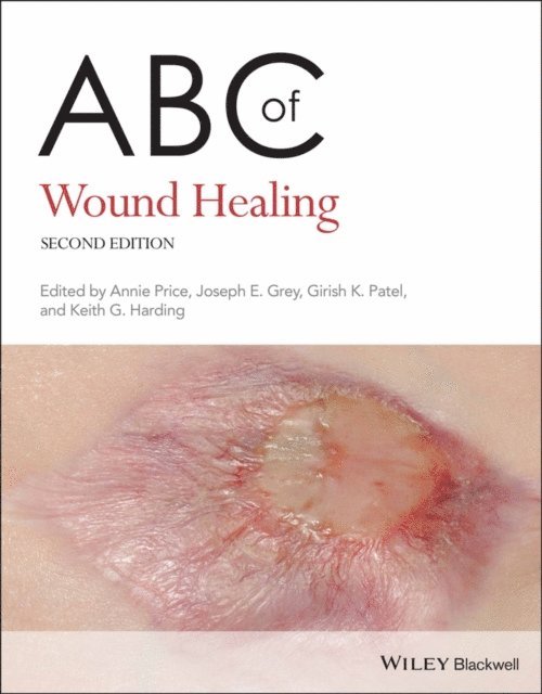 Keith G. Harding, Girish K. Patel, Joseph E. Grey, Annie Price - ABC of Wound Healing, E-bok