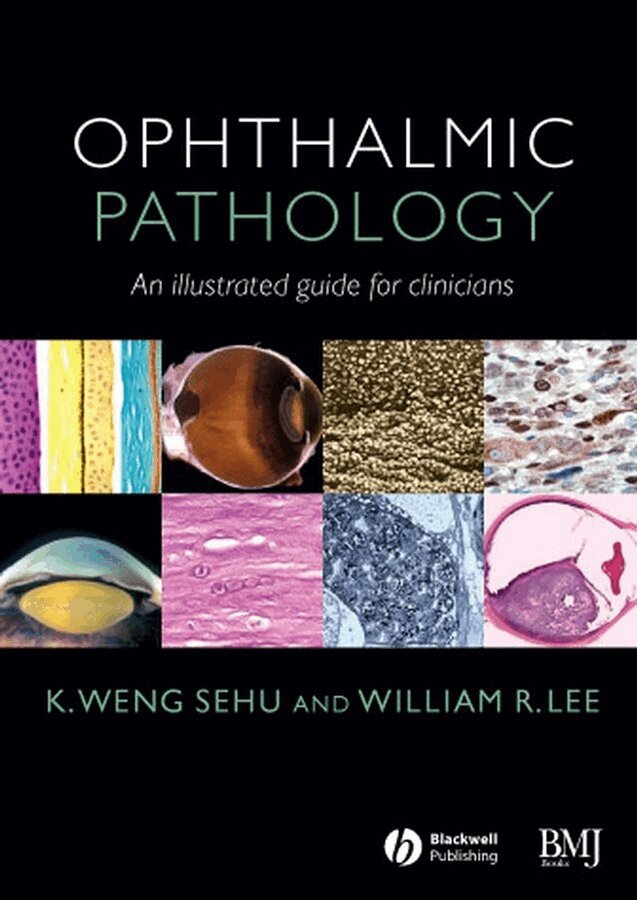 K. Weng Sehu, William R. Lee - Ophthalmic Pathology, E-bok