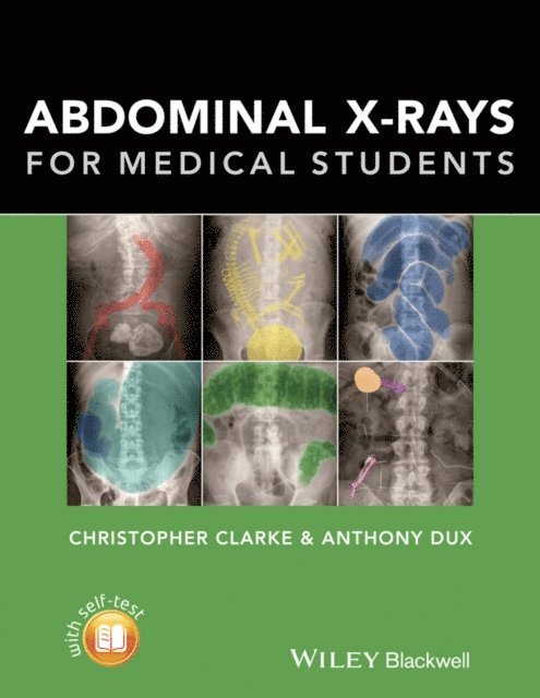 Anthony Dux, Christopher Clarke - Abdominal X-rays for Medical Students, E-bok. Tillgänglighet: Lägg i varukorg