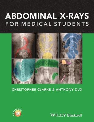 Christopher Clarke, Anthony Dux - Abdominal X-rays for Medical Students, Häftad. Tillgänglighet: Lägg i varukorg