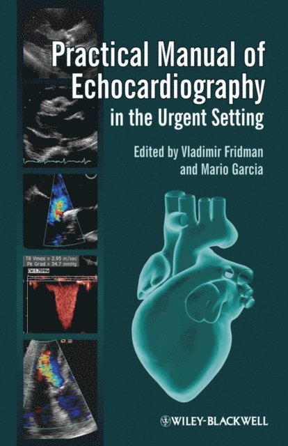 Mario Garcia, Vladimir Fridman - Practical Manual of Echocardiography in the Urgent Setting, E-bok