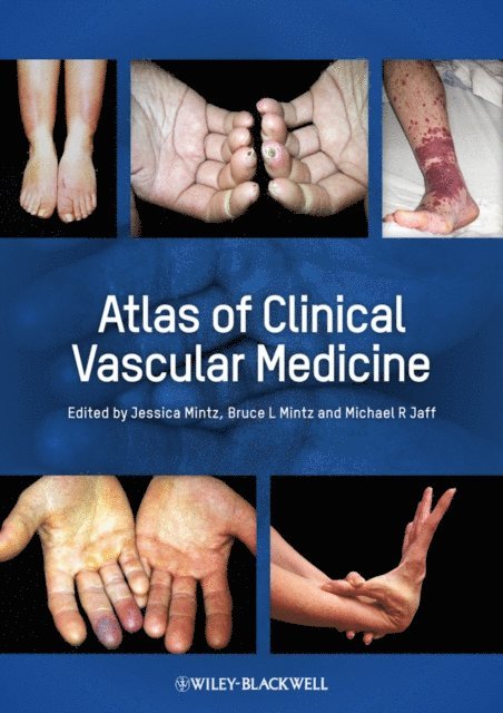 Jessica Mintz, Bruce L. Mintz, Michael R. Jaff - Atlas of Clinical Vascular Medicine, E-bok
